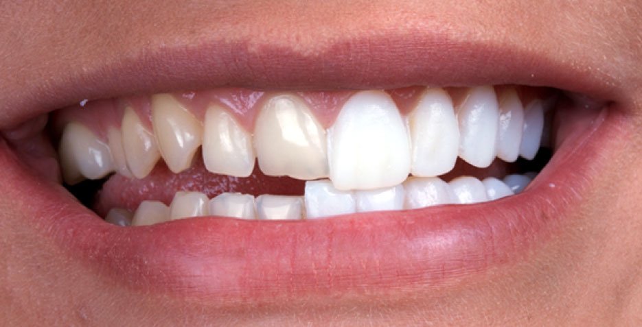 Cosmetic Dentistry
